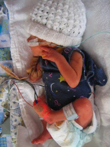 Lachlan in the SCBU