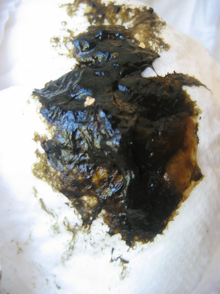 450px-Meconium.jpg
