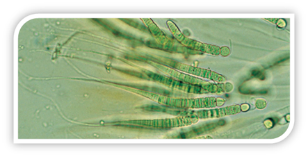 As cianobactérias são componentes do Plâncton e realizam fotossíntese.