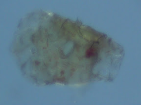 back lesion scab bot 60x.jpg