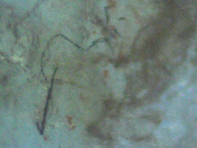 back lesion scab top 4 fiber 200x.jpg