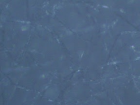 cotton swab 200x.jpg