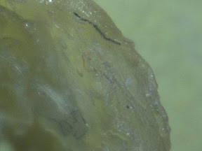 mucus fibers 60x 3.jpg