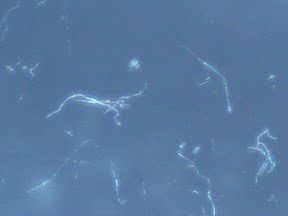 debris from torn tissue 60x.jpg