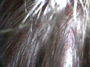 scalp hairs 1 10x.jpg