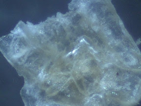 tinea foot skin 1 60x.jpg