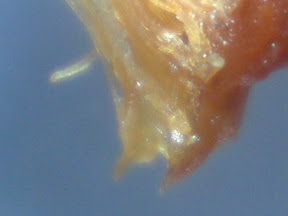 chicken skin 3 60x.jpg