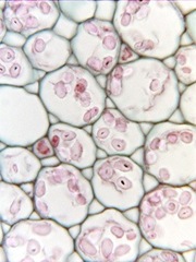 parenchyma