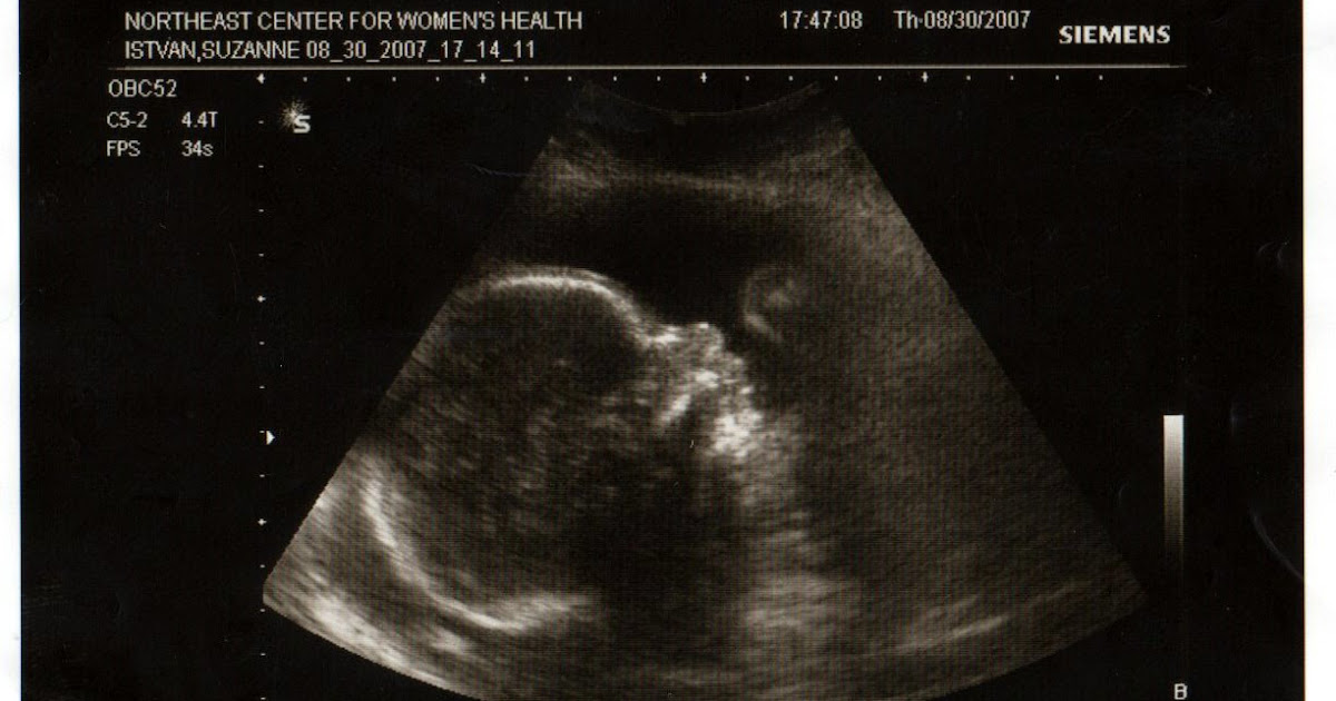 Thoughts of a Suzadam: 24 Week Ultrasound Picture